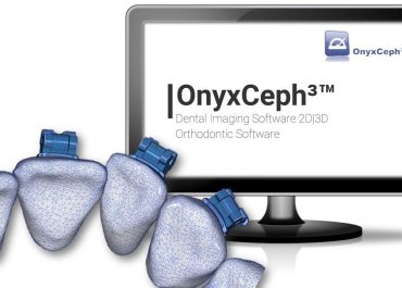 OnyxCeph 2021 (build 3.2.169) crack